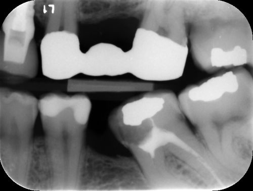 Программное обеспечение для выявления кариеса - ORCA DENTAL AI - для анализа изображений / для диагностики / клиническое