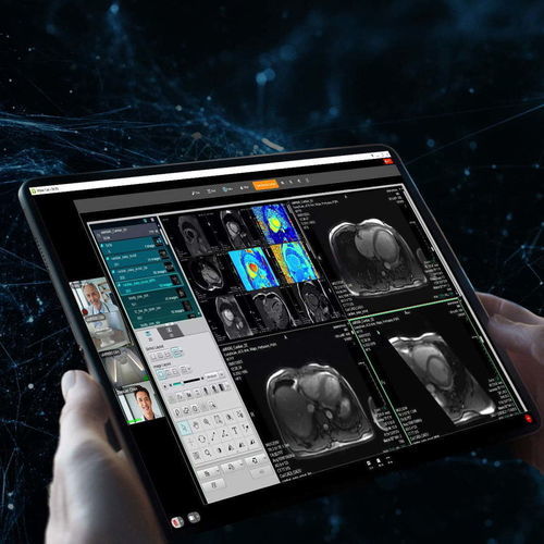 Система управления и связи для визуализации - uOmniscan - Shanghai United Imaging - DICOM-файла / для системы архивации и передачи изображений / видео