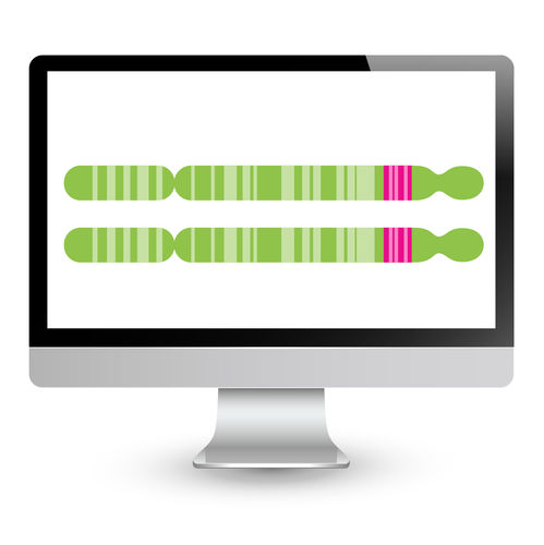 Анализатор молекулярной биологии для диагностики ЛЛМПД - EnFocus™ - Bionano Genomics