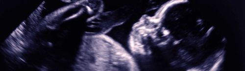 Программное обеспечение для анализа - Congenica Prenatal™ - Congenica Ltd - для диагностики / медицинское / клиническое