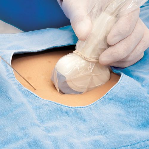 Защитный чехол для эхографических зондов - DUC8 series - Fairmont Medical