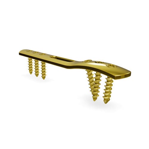 Компрессионная костная пластина для лодыжки - Malleolus 3.5 locking compression plate - Astrolabe - дистальная / боковая / блокируемая