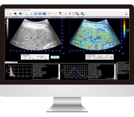 Программное обеспечение для ультразвуковых исследований - AmCAD-US - AmCad BioMed - для визуализации / для диагностики / для интерпретации