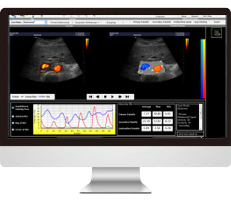 Программное обеспечение для анализа изображений - AmCAD-UV  - AmCad BioMed - для интерпретации / для ультразвуковых исследований / кровеносных сосудов