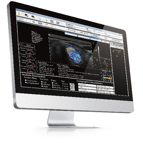 Программное обеспечение для ультразвуковых исследований - AmCAD-UT® - AmCad BioMed - для анализа изображений / для управления / для составления отчетности