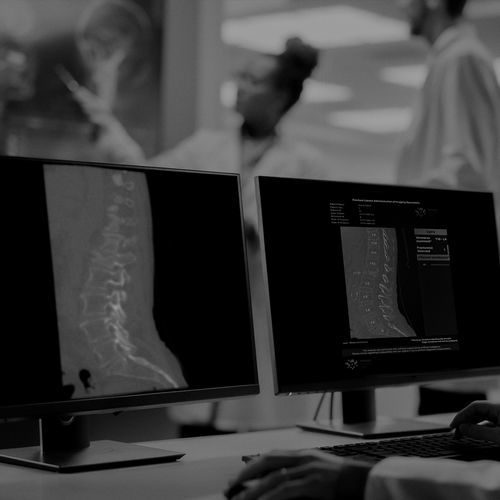 Программное обеспечение для обнаружения переломов - IB Lab FLAMINGO - Imagebiopsy Lab - для обработки / медицинское / клиническое