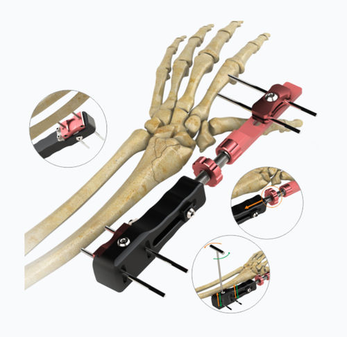 Внешний фиксатор для запястья - 5508-0000  - Zimed Medical - трубчатый