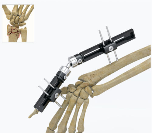 Внешний фиксатор для запястья - 5034 series - Zimed Medical - трубчатый