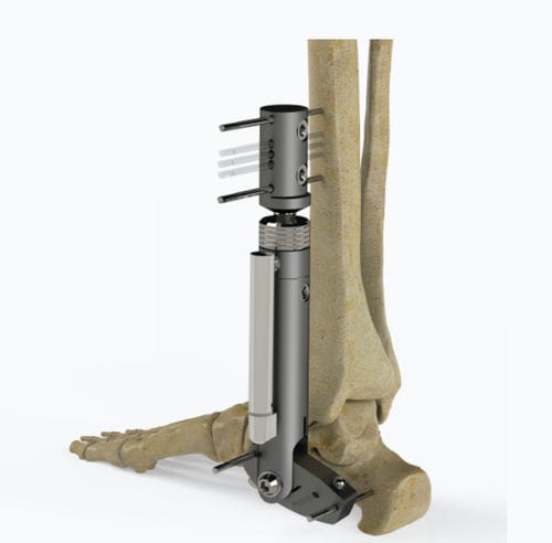 Внешний фиксатор для щиколотки - 5064-000 series - Zimed Medical - трубчатый