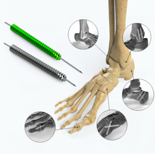 Компрессирующий винт для кости ступня - Zimed Medical - канюлированный / без головки / металлический