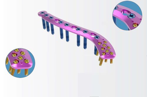 Компрессионная костная пластина для ключицы - TRUE LOCK Superior Distal Clavicle Anatomic - Truemed Medical - дистальная / блокируемая / металлическая