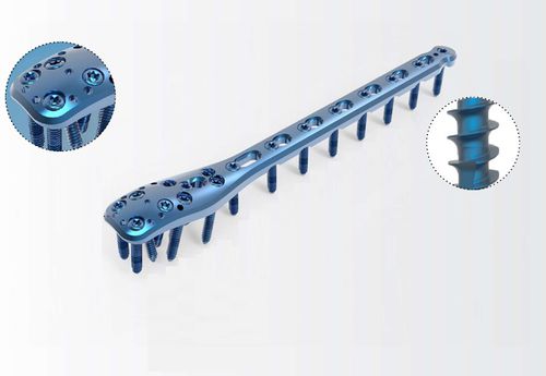 Компрессионная костная пластина плечевая кость - TRUE LOCK Proximal Humerus - Truemed Medical - проксимальная / блокируемая / металлическая