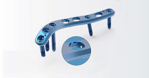 Компрессионная костная пластина плечевая кость - TRUE LOCK Proximal Humerus - Truemed Medical - дистальная / боковая / блокируемая