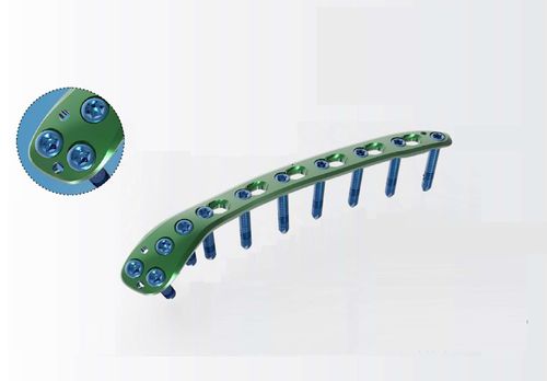 Компрессионная костная пластина плечевая кость - TRUE LOCK Distal Humerus Posterolateral - Truemed Medical - дистальная / заднебоковая / блокируемая
