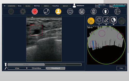 Программное обеспечение для ультразвуковых исследований - BR-FHUS Navigation™ - TaiHao Medical - визуализатор / для диагностики / для диагностики рака молочной железы