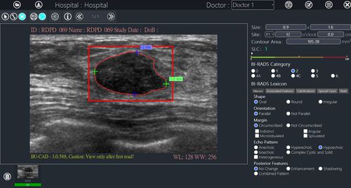 Программное обеспечение для анализа изображений - BU-CAD™ - TaiHao Medical - для составления отчетности / для диагностики / для интерпретации