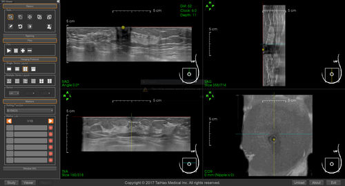 Программное обеспечение для составления отчетности - BR-Viewer™ - TaiHao Medical - визуализатор / для диагностики / для диагностики рака молочной железы