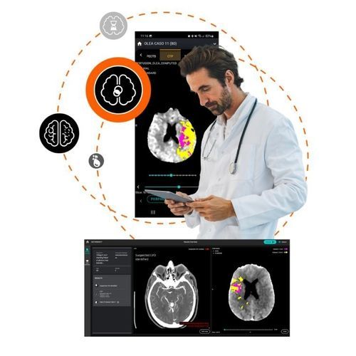 Программное обеспечение для обработки - Olea Medical - медицинское / для неотложной помощи