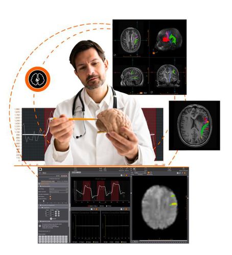 Программное обеспечение для визуализации - Olea Medical - с системой отслеживания / для нейронавигации / для картографии