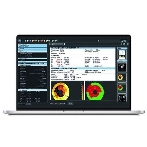 Программное обеспечение для анализа - SPHERE® 3.0 - Olea Medical - для визуализации / для измерений / для построения карт сердца