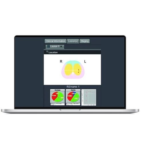 Программное обеспечение для МРТ - SPHERE® 3.0 - Olea Medical - для измерений / для анализа изображений / анализа данных