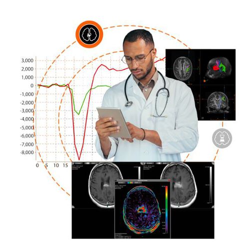 Программное обеспечение для МРТ - SPHERE® 3.0 - Olea Medical - анализа данных / для анализа изображений / для улучшения изображений
