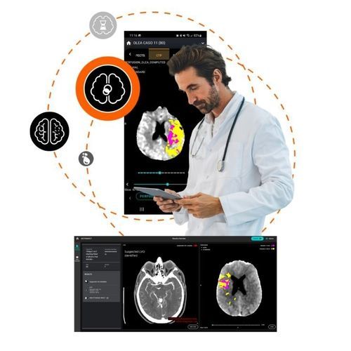 Программное обеспечение для анализа изображений - Olea Medical - медицинское / TDM / легкого