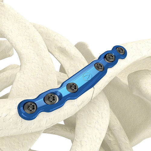 Компрессионная костная пластина для ключицы - PK-SMC0635NL-TI - WishBone Medical - медиальная / металлическая / педиатрическая