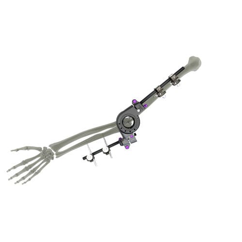 Внешний фиксатор для локтя - UniX® - WishBone Medical - трубчатый