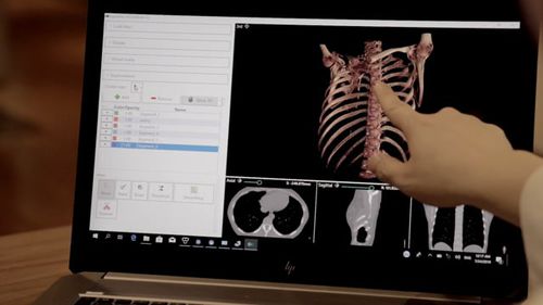 Программное обеспечение для визуализации 3D - DigiTwin - Medical Augmented Intelligence (MAI) - для диагностики / для обмена информацией / для обработки