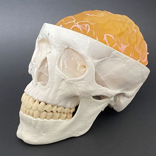 Анатомическая модель опухоли - Schiner3DRepro - мозга / для нейрохирургии / учебная