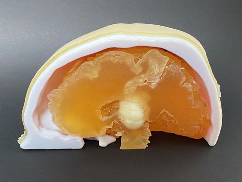 Анатомическая модель черепа - Schiner3DRepro - мозга / для нейрохирургии / учебная