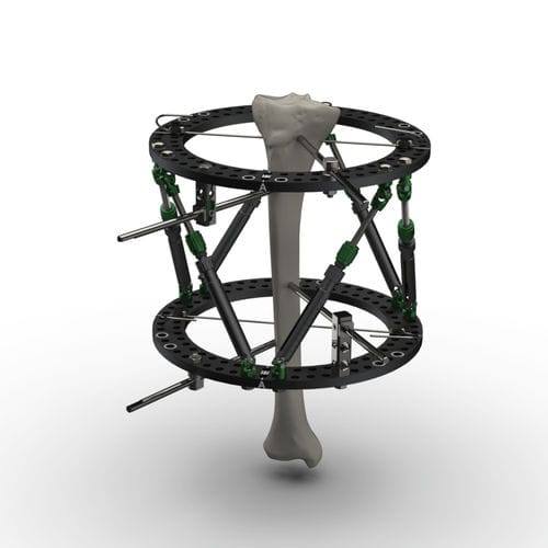 Модульный внешний фиксатор - Spider Frame®  - TASARIMMED - циркулярный / педиатрический