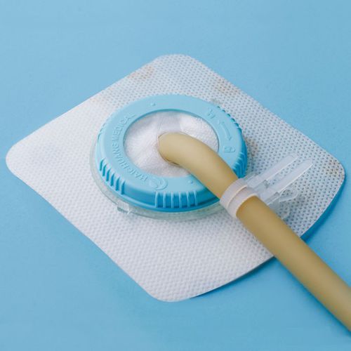 Фиксатор для катетера катетер для дренирования ран - Loopix™  - Zhejiang Haichuang Medical Device - тело / клейкий