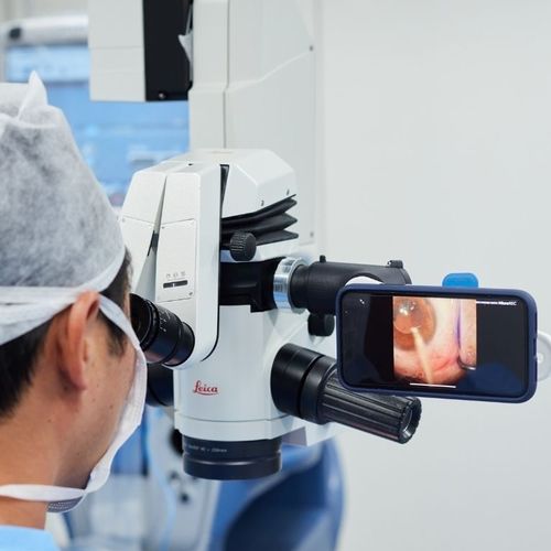Держатель для мобильного телефона для щелевой лампы - MicroREC  - Custom Surgical