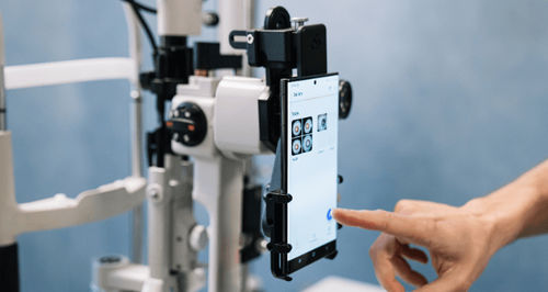 Держатель для мобильного телефона для щелевой лампы - OPTIREC - Custom Surgical