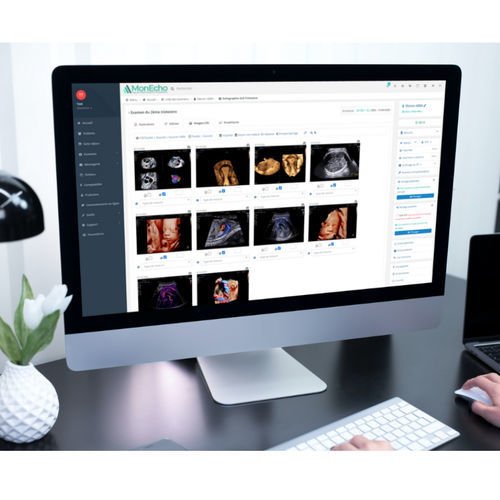 Программное обеспечение для ультразвуковых исследований - MONECHO - MonEcho - для медицинского кабинета / для больниц / для ЭКГ