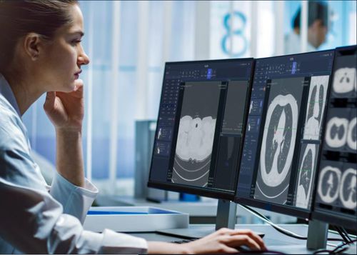 Программное обеспечение для диагностики - VUNO Med®-LungCT AI™ - VUNO - TDM / грудь / легкого