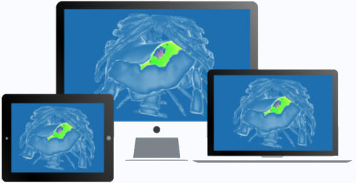 Хирургическое программное обеспечение - diSplay - InSimo - медицинское / клиническое / анатомическое