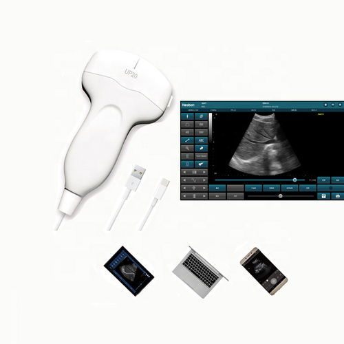 Портативный ультразвуковой сканер - HS-UP20 - Healson Technology - для эхографии в акушерстве и гинекологии / для брюшной и тазовой эхографии / для эхографии молочной железы