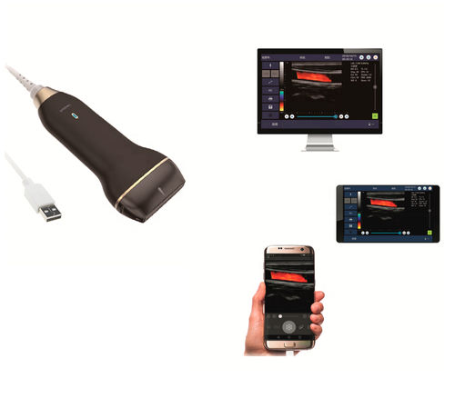 Портативный ультразвуковой сканер - C30L - Healson Technology - для костно-мышечной эхографии / для эхографии кожи / для операционной эхографии