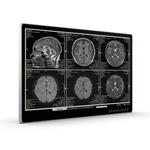 Монитор для медицинских снимков - UHD Surgical Monitor - Vecoton Technology - хирургический / разрешение 4K / противоослепляющий