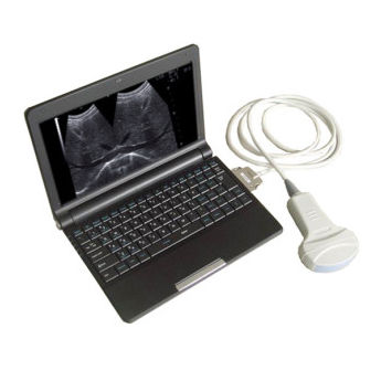 Ультразвуковой сканер для поливалентной эхографии - Arterial Doppler - Tianjin Guyufan Biological Technology - переносной / черно-белый / цветовой допплер