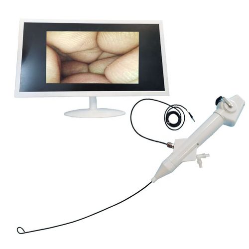 Видеоуретероскоп для одноразового использования -  Ureter Flexible Nephroscope - Tianjin Guyufan Biological Technology