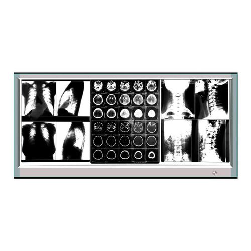 Негатоскоп 3 диапазона - GP1003A - Bellamoon Medical - светодиод