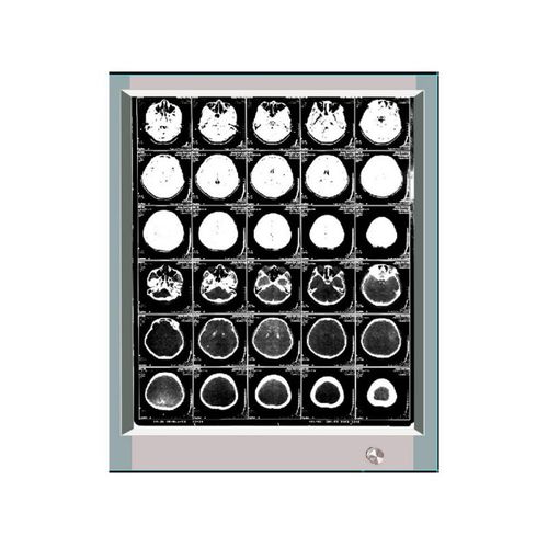 Негатоскоп 1 диапазон - GP1001A - Bellamoon Medical - светодиод