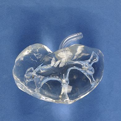 Анатомическая модель таз - Trando 3D Medical Technology - почки / мочеточника / для хирургии