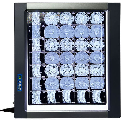 Негатоскоп светодиод - MST-4000I - Shantou Easywell Electronic Technologies - цифровой / 1 диапазон