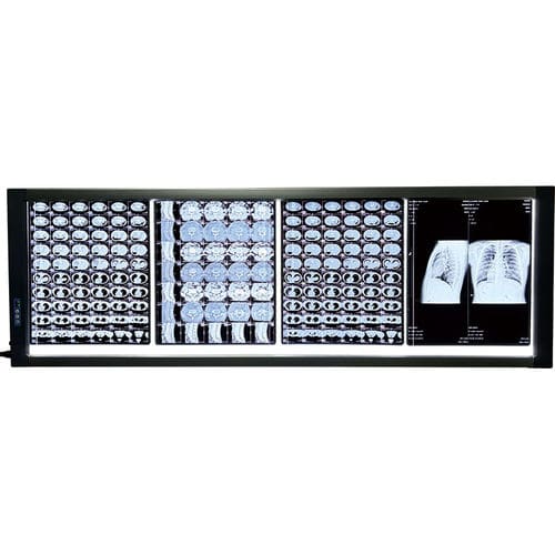 Цифровой негатоскоп - MST-4000IV  - Shantou Easywell Electronic Technologies - 4 диапазона / светодиод