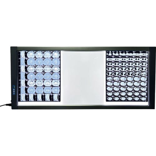Цифровой негатоскоп - MST-4000III - Shantou Easywell Electronic Technologies - 3 диапазона / светодиод